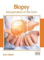 Biopsy: Interpretation of the Liver (Hardcover): Kate Holland