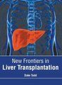 New Frontiers in Liver Transplantation (Hardcover): Duke Todd