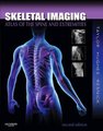 Skeletal Imaging - Atlas of the Spine and Extremities (Hardcover, 2nd edition): John A.M. Taylor, Tudor H. Hughes, Donald L....