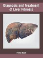 Diagnosis and Treatment of Liver Fibrosis (Hardcover): Finley Bush