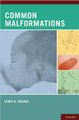 Common Malformations (Hardcover): Lewis B Holmes