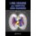 Lung Imaging and Computer Aided Diagnosis (Hardcover, New): Ayman El-Baz, Jasjit S. Suri