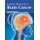 Current Research in Brain Cancer (Hardcover): Carmen Ferguson