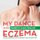 My Dance with Eczema - And 80 Lessons for the Patient and the Doctor (Paperback): Derrick Chen Wee Aw