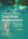A Beginner's Guide to Total Knee Replacement (Hardcover): L. Prakash