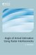 Angle-of-Arrival Estimation Using Radar Interferometry - Methods and applications (Hardcover): Jeff Holder