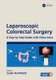 Laparoscopic Colorectal Surgery - A Step by Step Guide with Video Atlas (Hardcover): Sanjiv Haribhakti