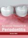 Advanced Research in Periodontitis (Hardcover): Norman Waltz
