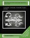2000-2004 FIAT PUNTO Turbocharger Rebuild and Repair Guide - 712766-0001, 712766-5001, 712766-9001, 712766-1, 46779032...