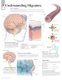 Understanding Migraines Laminated Poster (Poster): Scientific Publishing