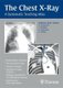 The Chest X-Ray - A Systematic Teaching Atlas (Paperback): Matthias Hofer