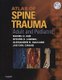 Atlas of Spine Trauma - Adult and Pediatric (Hardcover): Daniel H. Kim, Steven C. Ludwig, Alexander R Vaccaro, Jae-Chil Chang