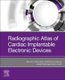 Radiographic Atlas of Cardiac Implantable Electronic Devices (Paperback): Majid Haghjoo, Farzad Kamali, Amirfarjam Fazelifar