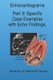 Echocardiograms - Part 3 - Specific Case Examples with Echo Findings. (Paperback): Richard M. Fleming