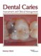 Dental Caries: Assessment and Clinical Management (Hardcover): Marcus Ward