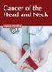 Cancer of the Head and Neck (Hardcover): Katelyn Harding
