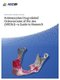 Antiresorptive Drug-Related Osteonecrosis of the Jaw (ARONJ) - A Guide to Research (Paperback): Kenneth Fleisher, Risto Kontio,...