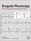 Brugada Phenocopy - The Art of Recognizing the Brugada ECG Pattern (Paperback): Adrian Baranchuk