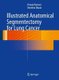 Illustrated Anatomical Segmentectomy for Lung Cancer (Hardcover, 2012 ed.): Hiroaki Nomori, Morihito Okada