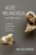 Acute Melancholia and Other Essays - Mysticism, History, and the Study of Religion (Paperback): Amy Hollywood
