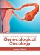Current Status and Future Perspectives of Gynecological Oncology (Hardcover): Aurora Moran