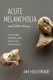 Acute Melancholia and Other Essays - Mysticism, History, and the Study of Religion (Hardcover): Amy Hollywood