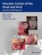 Vascular Lesions of the Head and Neck - Diagnosis and Management (Hardcover): Mark S Persky, Milton Waner, Francine Blei,...