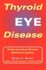Thyroid Eye Disease - Understanding Graves' Opthalmopathy (Paperback): Elaine Moore