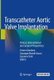 Transcatheter Aortic Valve Implantation - Clinical, Interventional and Surgical Perspectives (Hardcover, 1st ed. 2019): Arturo...