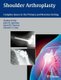 Shoulder Arthroplasty - Complex Issues in the Primary and Revision Setting (Hardcover): Stephen Fealy, John W. Sperling,...