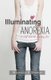 Illuminating Anorexia - A Self Worth Living For (Paperback): Michelle Sparkes